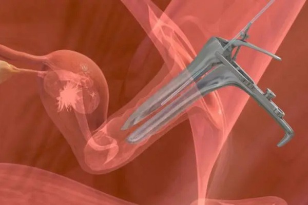 Blastocyst Transfer img