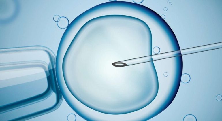 ICS process at Pune IVF Fertility Centre
